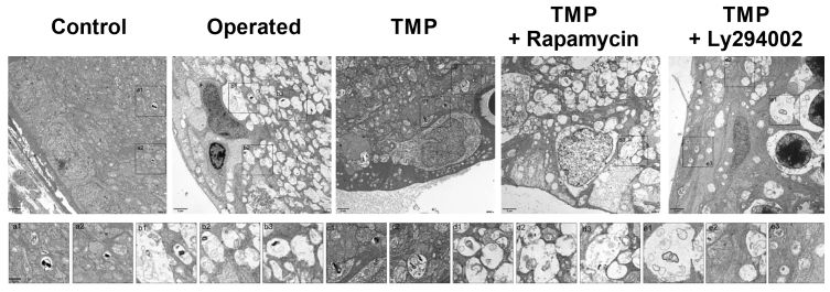 Ligustrazine protects against chronic hypertensive glaucoma in rats by inhibiting autophagy via the PI3K-Akt/mTOR pathway.