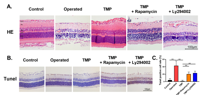 Ligustrazine protects against chronic hypertensive glaucoma in rats by inhibiting autophagy via the PI3K-Akt/mTOR pathway.