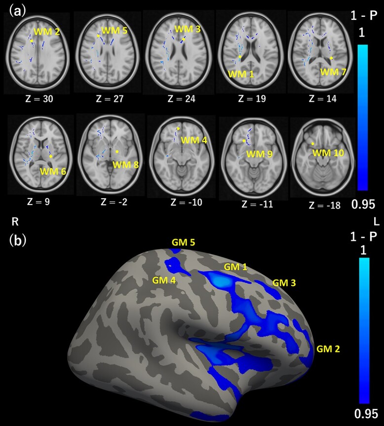 Microstructural Properties of Human Brain Revealed by Fractional Anisotropy Can Predict the After-Effect of Intermittent Theta Burst Stimulation.