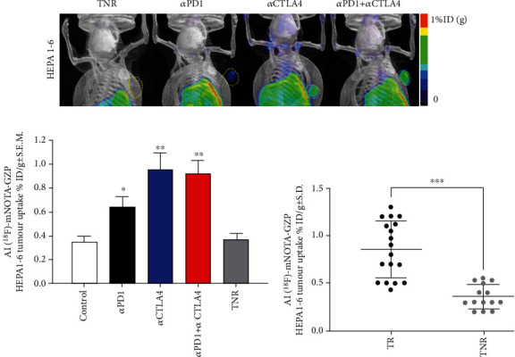 Granzyme B PET Imaging Stratifies Immune Checkpoint Inhibitor Response in Hepatocellular Carcinoma.