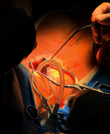 Airway Management and Anesthesia for Tracheal Resection in a 68-Year-Old: 3 Airways for the Price of 1.