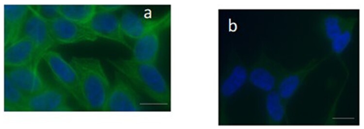 Redox imbalance induced by docetaxel in the neuroblastoma SH-SY5Y cells: a study of docetaxel-induced neuronal damage.