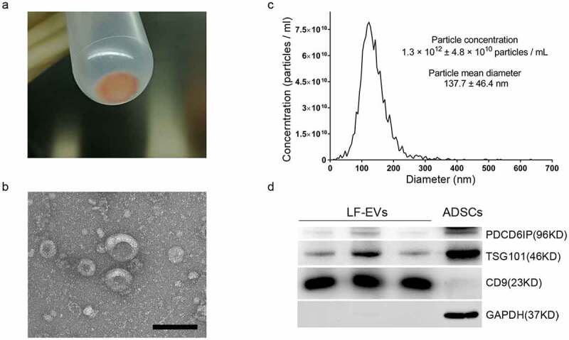 Extracellular vesicles derived from lipoaspirate fluid promote fat graft survival.