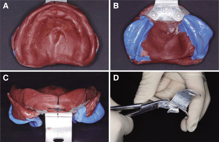 Evaluation of functional suitable digital complete denture system based on 3D printing technology.