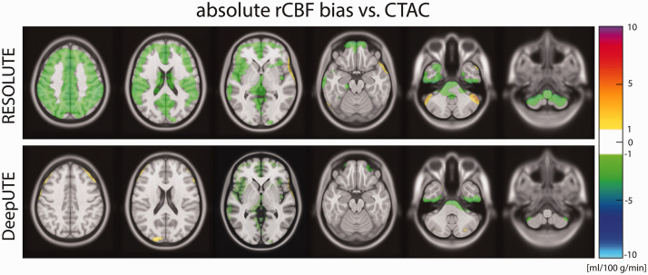 Deep-learning-based attenuation correction in dynamic [<sup>15</sup>O]H<sub>2</sub>O studies using PET/MRI in healthy volunteers.