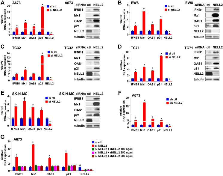 EZH2 suppresses endogenous retroviruses and an interferon response in cancers.