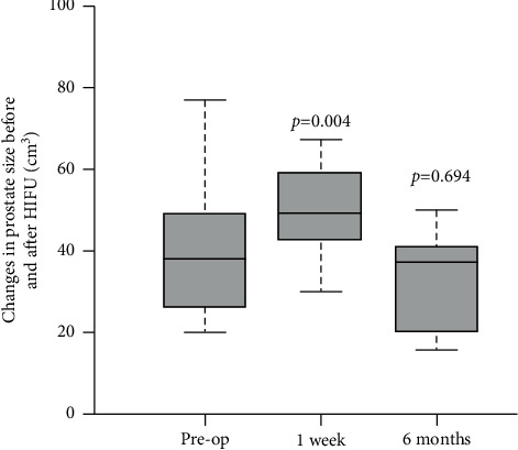 High-Intensity Focused Ultrasound (HIFU) Focal Therapy for Localized Prostate Cancer with MRI-US Fusion Platform.