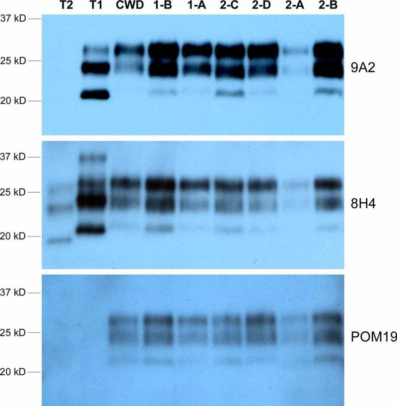 Detection of two dissimilar chronic wasting disease isolates in two captive Rocky Mountain elk (<i>Cervus canadensis</i>) herds.