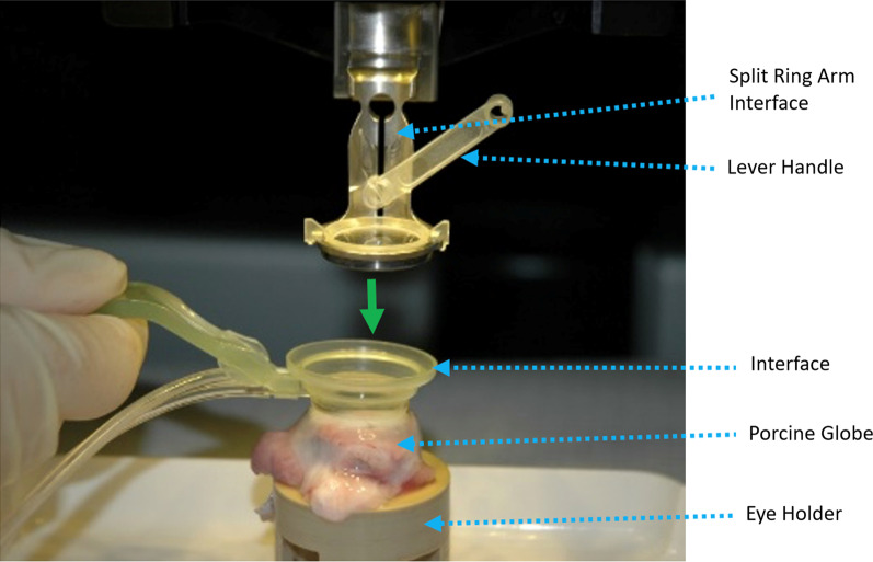 Accuracy and safety of partial thickness femtosecond laser radial and arcuate keratotomy incisions in porcine eyes.