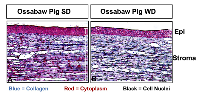 Collagen matrix perturbations in corneal stroma of Ossabaw mini pigs with type 2 diabetes.