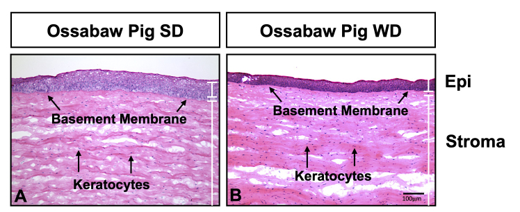 Collagen matrix perturbations in corneal stroma of Ossabaw mini pigs with type 2 diabetes.