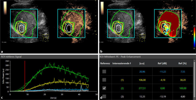 Contrast-enhanced ultrasound perfusion imaging of organs.