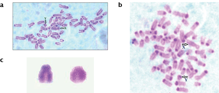 ﻿A rare chromosomal polymorphism in a Kangayam bull (<i>Bosindicus</i>) of south India.