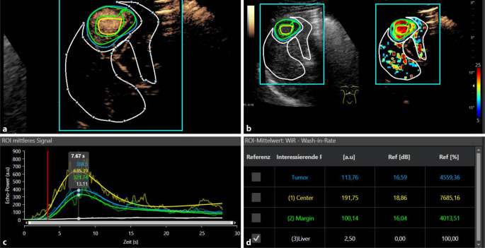 Contrast-enhanced ultrasound perfusion imaging of organs.