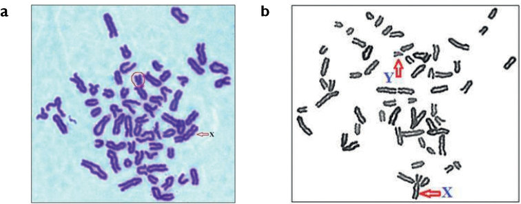 ﻿A rare chromosomal polymorphism in a Kangayam bull (<i>Bosindicus</i>) of south India.