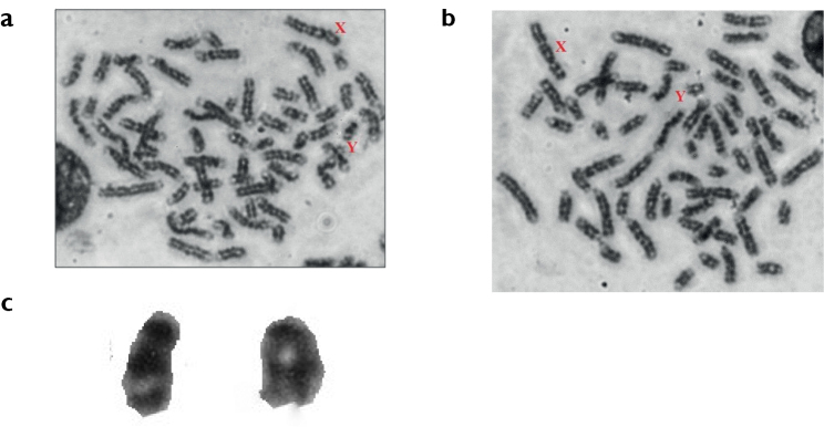 ﻿A rare chromosomal polymorphism in a Kangayam bull (<i>Bosindicus</i>) of south India.