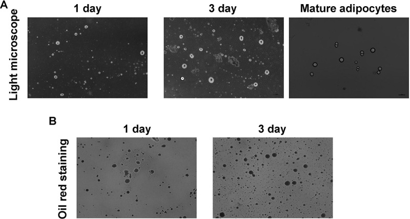 <i>Porphyromonas gingivalis</i> lipopolysaccharide (Pg-LPS) influences adipocytes injuries through triggering XBP1 and activating mitochondria-mediated apoptosis.