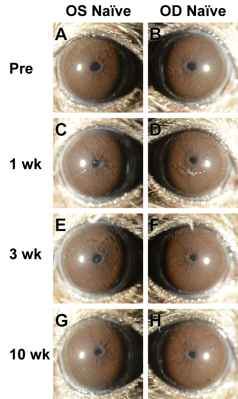 Recombinant adenovirus causes prolonged mobilization of macrophages in the anterior chambers of mice.