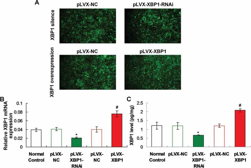 <i>Porphyromonas gingivalis</i> lipopolysaccharide (Pg-LPS) influences adipocytes injuries through triggering XBP1 and activating mitochondria-mediated apoptosis.