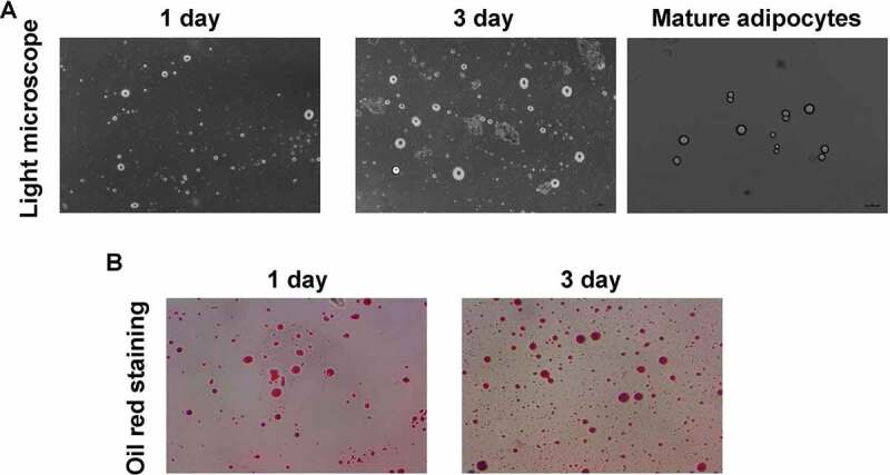 <i>Porphyromonas gingivalis</i> lipopolysaccharide (Pg-LPS) influences adipocytes injuries through triggering XBP1 and activating mitochondria-mediated apoptosis.