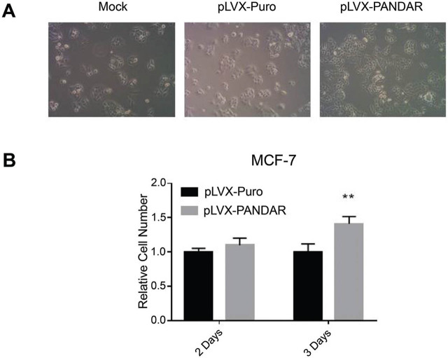 Regulatory roles of lncRNA <i>PANDAR</i> in breast cancer cell proliferation.