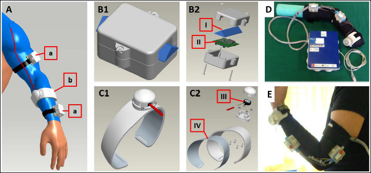 AUTOMA: a wearable device to assess the upper limb muscular activity in patients with neuromuscular disorders.