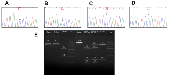 Prevalence of primary mutations in Leber hereditary optic neuropathy: A five-year report from a tertiary eye care center in India.