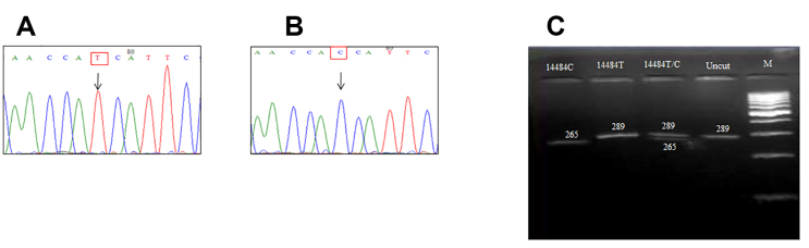 Prevalence of primary mutations in Leber hereditary optic neuropathy: A five-year report from a tertiary eye care center in India.