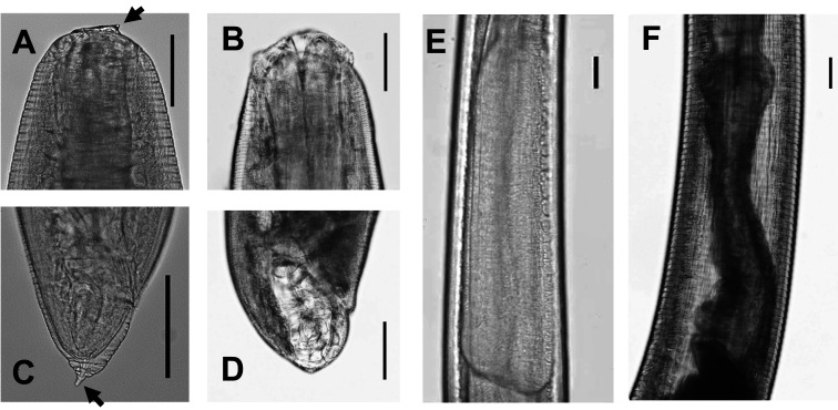 Current Status of Anisakiasis and <i>Anisakis</i> Larvae in Tokyo, Japan.