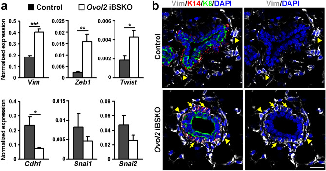 Altered Epithelial-mesenchymal Plasticity as a Result of Ovol2 Deletion Minimally Impacts the Self-renewal of Adult Mammary Basal Epithelial Cells.