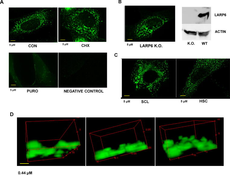 Imaging of type I procollagen biosynthesis in cells reveals biogenesis in highly organized bodies; Collagenosomes