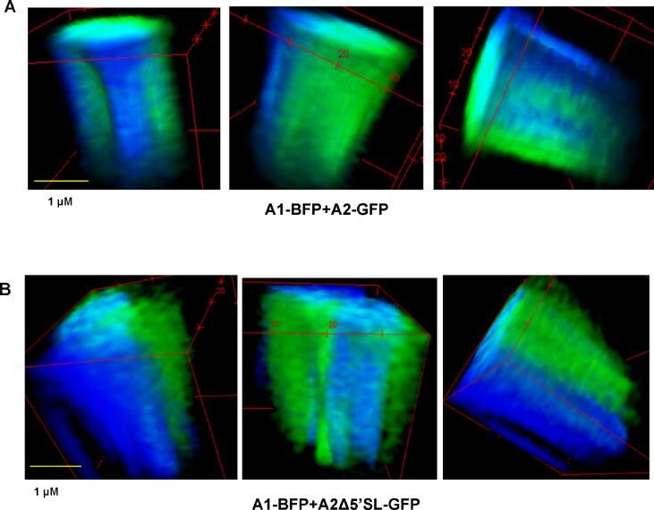 Imaging of type I procollagen biosynthesis in cells reveals biogenesis in highly organized bodies; Collagenosomes