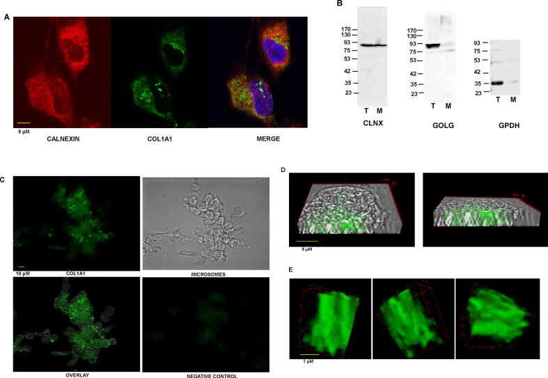 Imaging of type I procollagen biosynthesis in cells reveals biogenesis in highly organized bodies; Collagenosomes