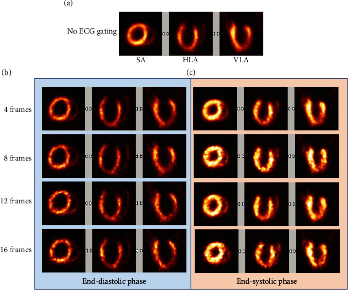 The Number of Frames on ECG-Gated <sup>18</sup>F-FDG Small Animal PET Has a Significant Impact on LV Systolic and Diastolic Functional Parameters.