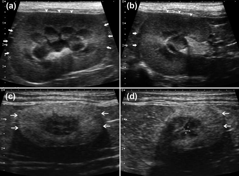 Absence of renal cortical anisotropic backscattering artifact in feline chronic kidney disease.