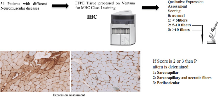 The Assessment of Major Histocompatibility Complex (MHC) Class-I Expression in Different Neuromuscular Diseases.