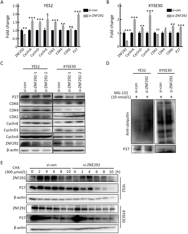 ZNF292 suppresses proliferation of ESCC cells through ZNF292/SKP2/P27 signaling axis.