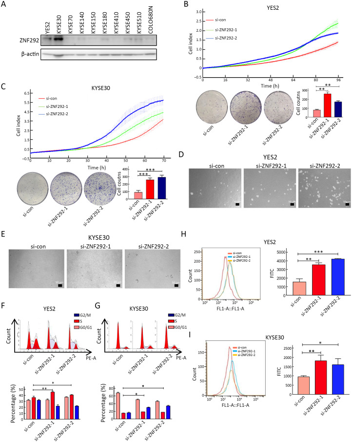 ZNF292 suppresses proliferation of ESCC cells through ZNF292/SKP2/P27 signaling axis.