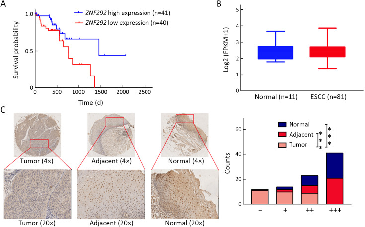 ZNF292 suppresses proliferation of ESCC cells through ZNF292/SKP2/P27 signaling axis.