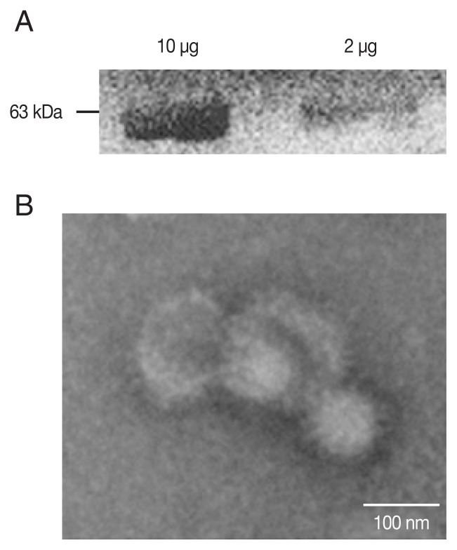 Detection of Toxoplasma gondii Infections using Virus-Like Particles Displaying T. gondii ROP4 Antigen.