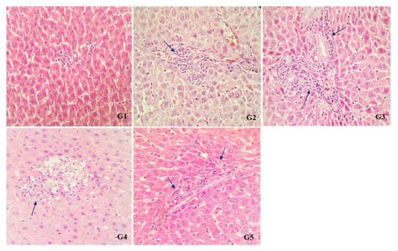 N-Acetyl cysteine mitigates histopathological changes and inflammatory genes expressions in the liver of cadmium exposed rats.