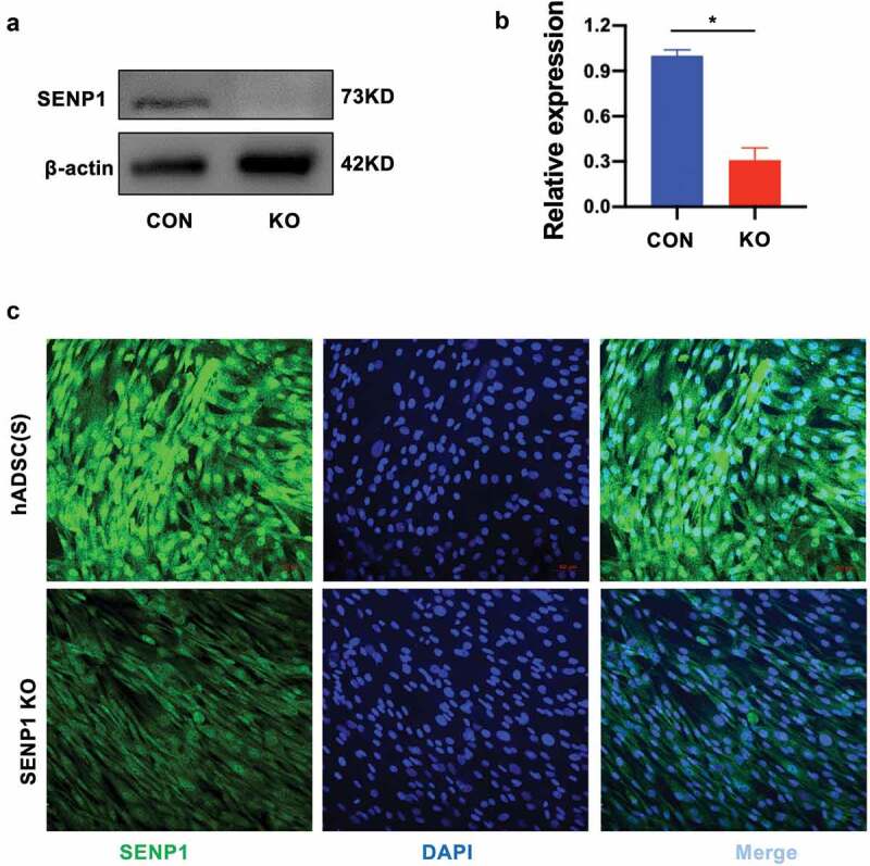 SENP1 is required for the growth, migration, and survival of human adipose-derived stem cells.