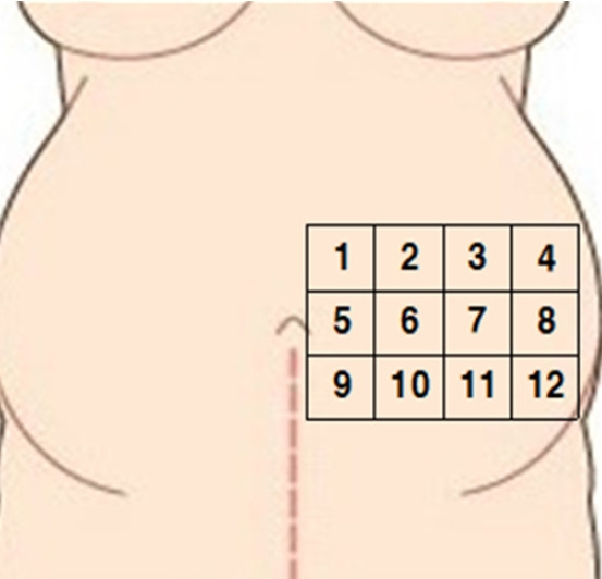 Abdominal skin subcutaneous fat thickness over the gestational period in Korean pregnant women: a descriptive observational study.