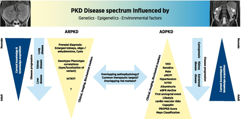 Translational research approaches to study pediatric polycystic kidney disease.