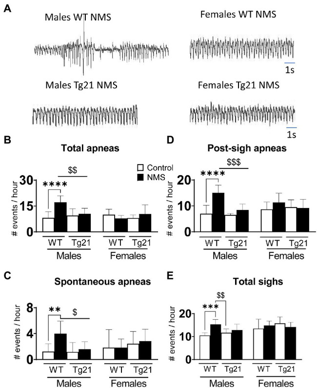 Cerebral Erythropoietin Prevents Sex-Dependent Disruption of Respiratory Control Induced by Early Life Stress.