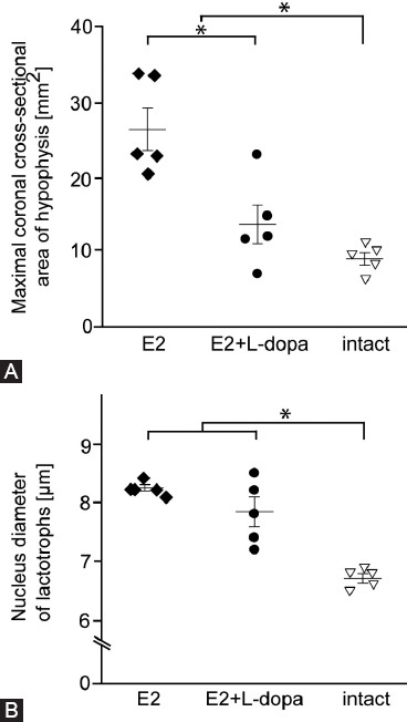 Effects of L-dopa on expression of prolactin and synaptotagmin IV in 17-beta-estradiol-induced prolactinomas of ovariectomized hemiparkinsonian rats.