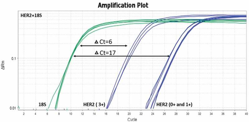 HER2 overexpression is a putative diagnostic and prognostic biomarker for late-stage colorectal cancer in North African patients.