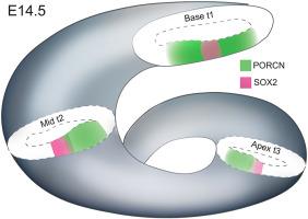 Spatial and temporal expression of PORCN is highly dynamic in the developing mouse cochlea