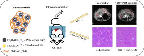 Engineering chitosan nano-cocktail containing iron oxide and ceria: A two-in-one approach for treatment of inflammatory diseases and tracking of material delivery