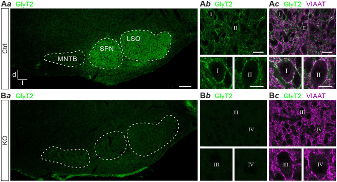 Glycinergic Transmission in the Presence and Absence of Functional GlyT2: Lessons From the Auditory Brainstem.